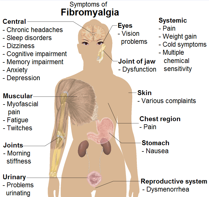 How Is Fibromyalgia Diagnosed?