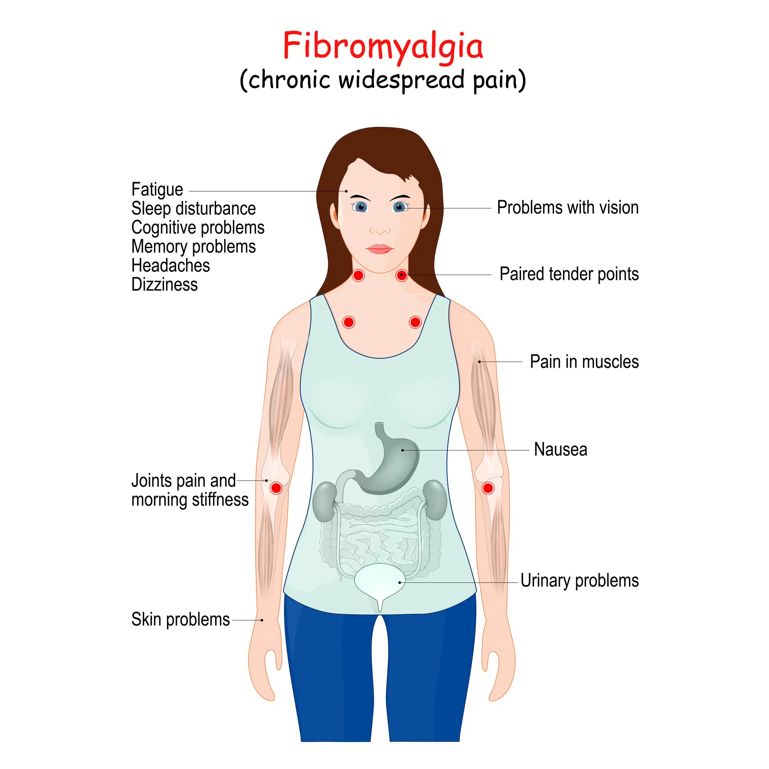 Fibromyalgia in Women: Why Symptoms Are More Common